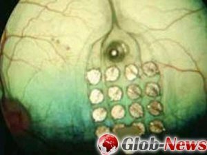 Нейробиологи передали текст на сетчатку глаза слепого больного